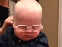 Baby with Albinism sees mother for the first time with glasses\