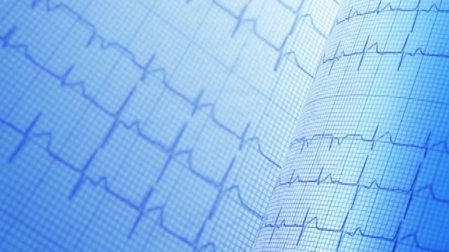 Medtronic, con l'IA rivoluzione nel  monitoraggio cardiaco