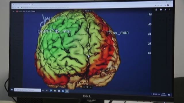 Una macchina non invasiva combatte le malattie neuropsichiatriche
