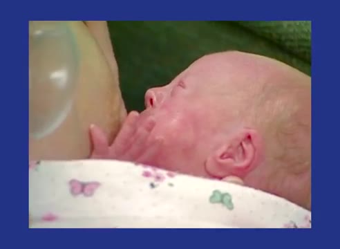 allattamento neonati prematuri